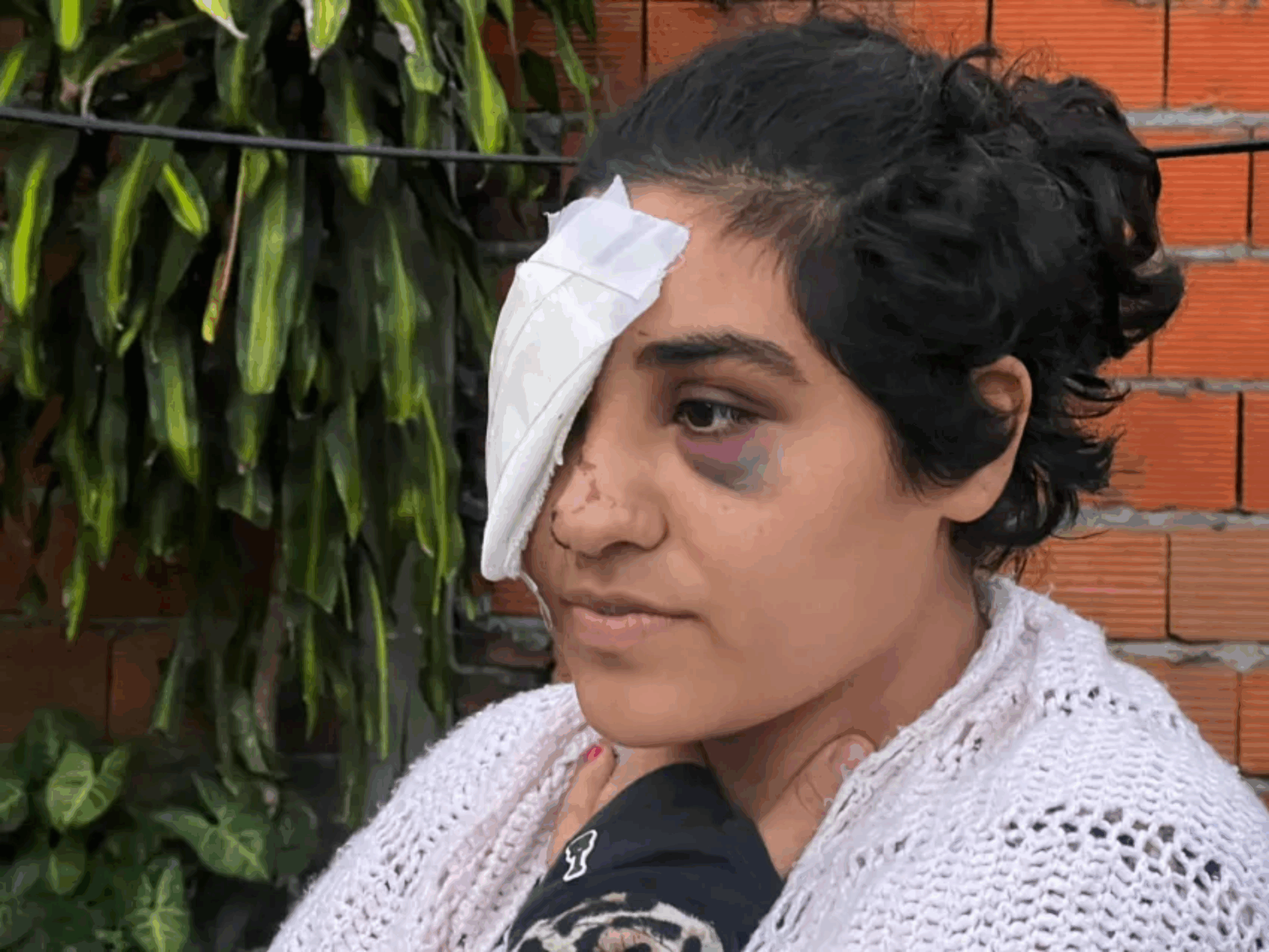 Dio su testimonio la víctima de la golpiza en la Toma